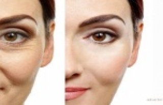 Botoks estetik kadar sağlık için de kullanılıyor