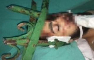 Alanya'daki kazada gencin yüzüne saplanan çubuk...