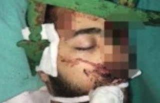 Alanya'daki kazada yüzüne demir çubuk saplandı