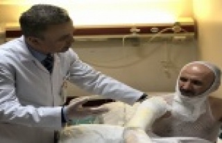 Uzmanlar uyarıyor, yanık durumlarında dikkat!