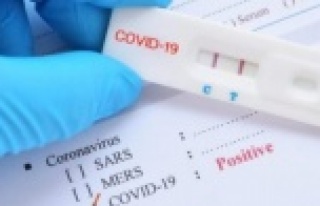 Alanyalılara çok önemli Covid-19 test uyarısı