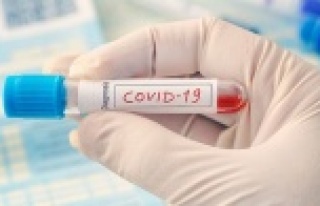 Bilim insanları, bazı kan gruplarının Covid-19'a...