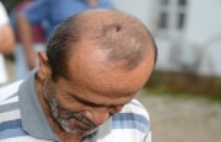 Doluya açık alanda yakalandı, başından yaralandı