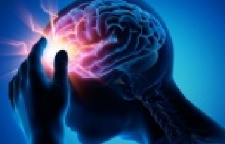 Beyin anevrizmasında nedeniyle yılda 7 bin kişi...