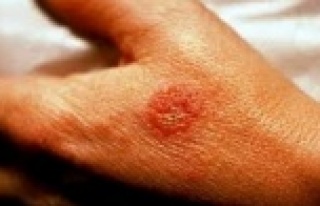 Egzamaya dikkat! pandemi egzamayı arttırdı mı?