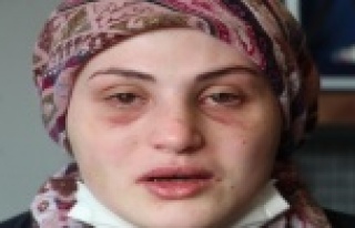 Kaçarak evlendiği eşi, genç kadına kabusu yaşattı