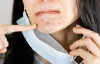 Maske sonrası artan cilt problemlerine önlem de...