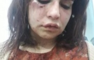Alanya'da eski sevgilisi tarafından darp edilen...
