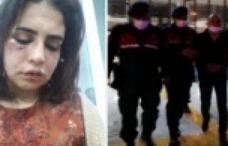 Alanya'da eski sevgilisini bu hale getiren zanlı...