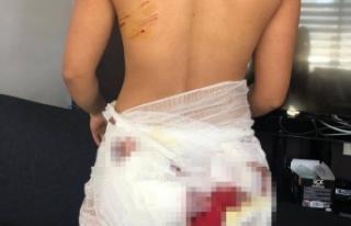 Antalya'da sokak köpeklerinin saldırısına...