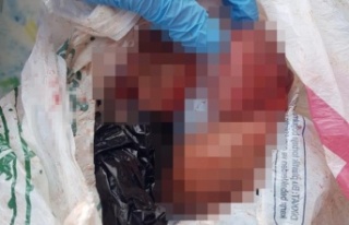 Cadde ortasında düşük yapan kadın, bebeğini...