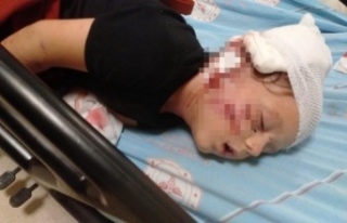 Minik Yağız'ın köpeğin saldırısına uğrayıp...