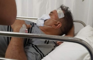 Alanya'da eski başkan vekili kaza yaptı