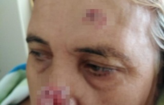 Çocuk parkında pitbull dehşeti