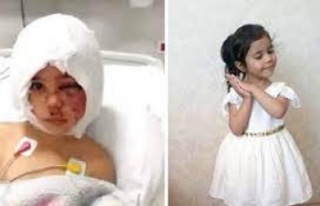 Pitbull saldırısında yaralanan Asiye'ye bir...