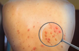 Maymun değil, su çiçeğiymiş